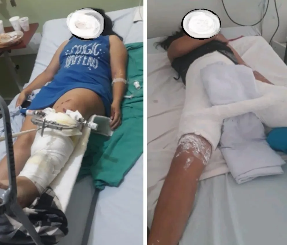 Sufrieron lesiones graves en un choque, deben operarlas y su familia necesita ayuda