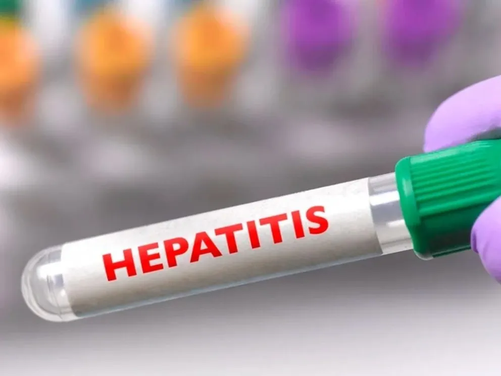 Hepatitis de origen desconocido: confirman el primer caso en Neuquén 